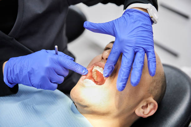 Best Emergency Wisdom Teeth Removal in Sitka, AK