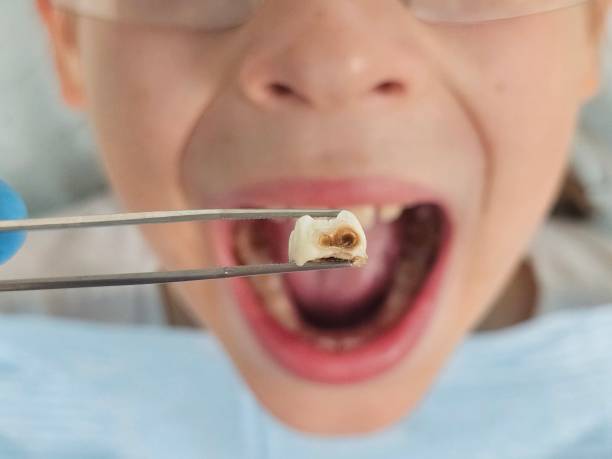 Best Emergency Treatment for Toothache in Sitka, AK